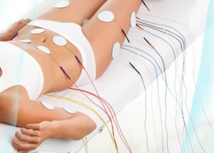 МИОСТИМУЛЯЦИЯ